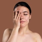 Top 6 Solutions for Treating Fungal Acne
